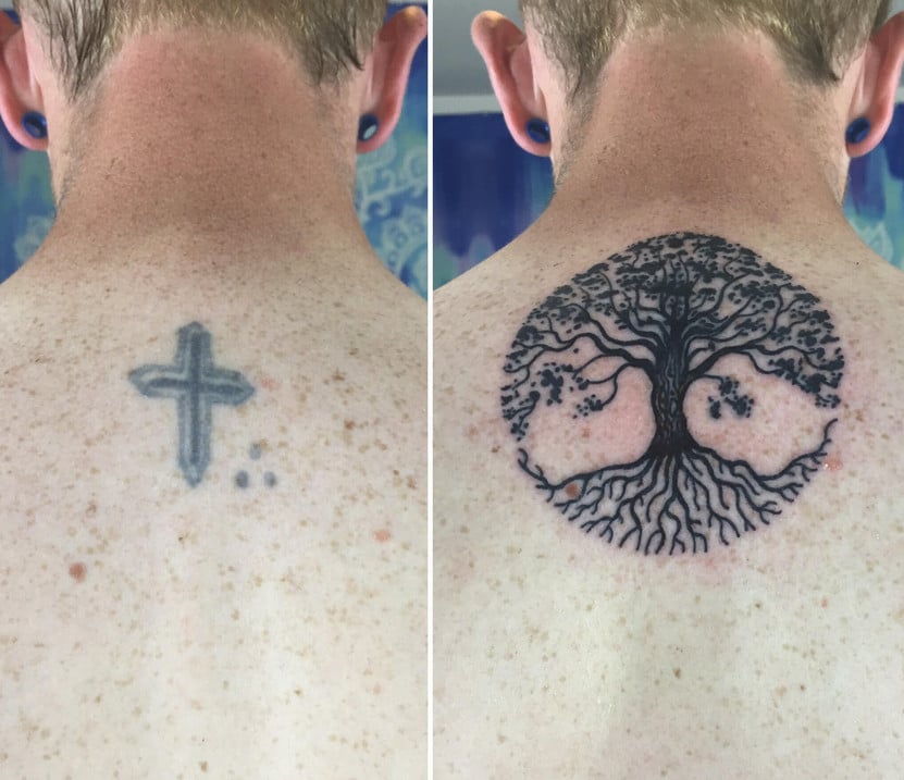 cobrir tatuagem antes e depois nuca