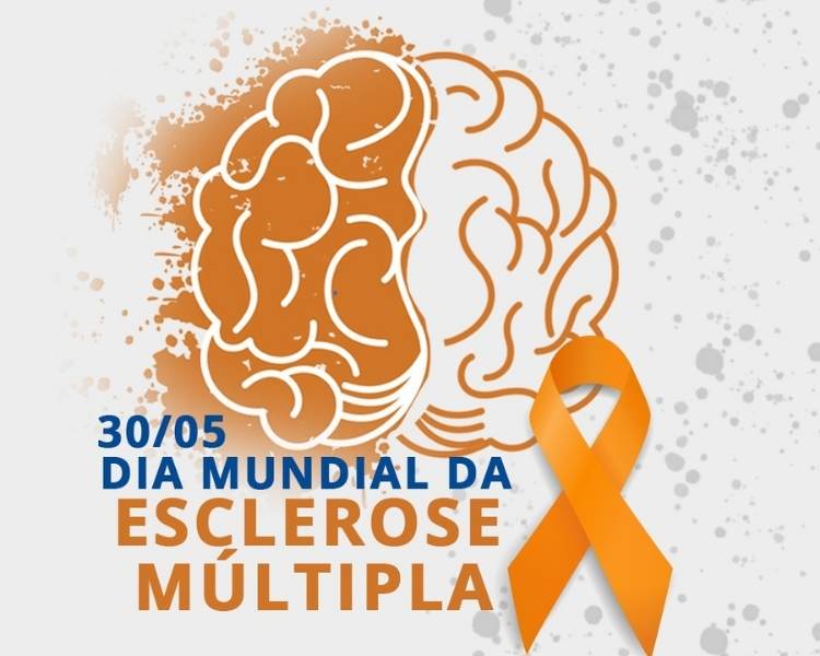 Foto ilustrativa de cérebro sobre o Dia Mundial da Esclerose Múltipla.