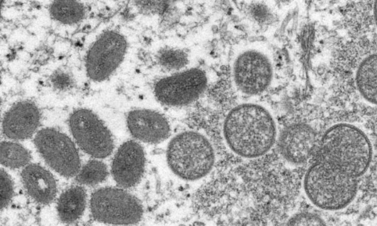 Vírus da varíola dos macacos no microscópio. 