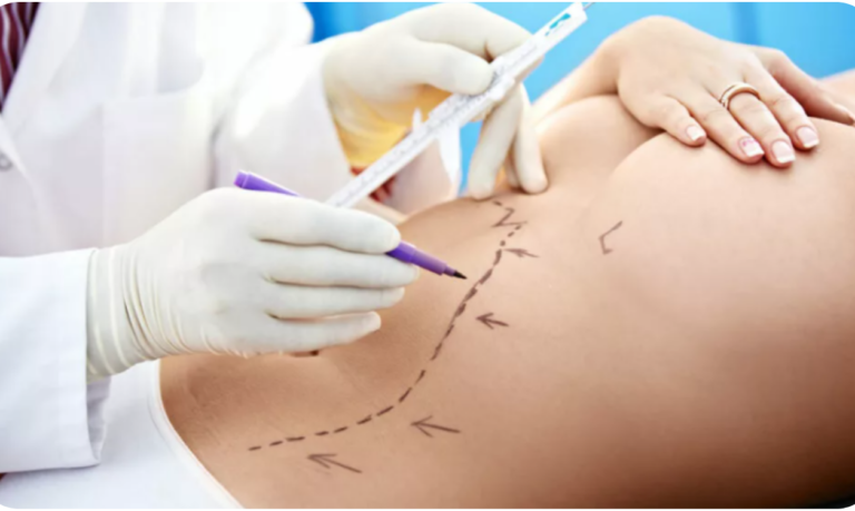 médico fazendo cirurgia