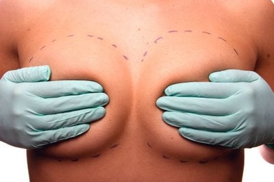 Saiba o que fazer antes e depois da cirurgia de aumento das mamas