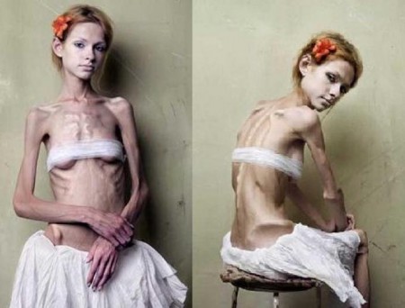 Israel proíbe publicidade com modelos muito magras