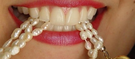 Clareamento Dental – Conheça os tipos e saiba como deixar seu sorriso ainda mais bonito