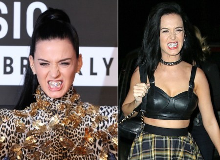 Grillz: acessórios de dentes são os novos queridinhos das celebridades