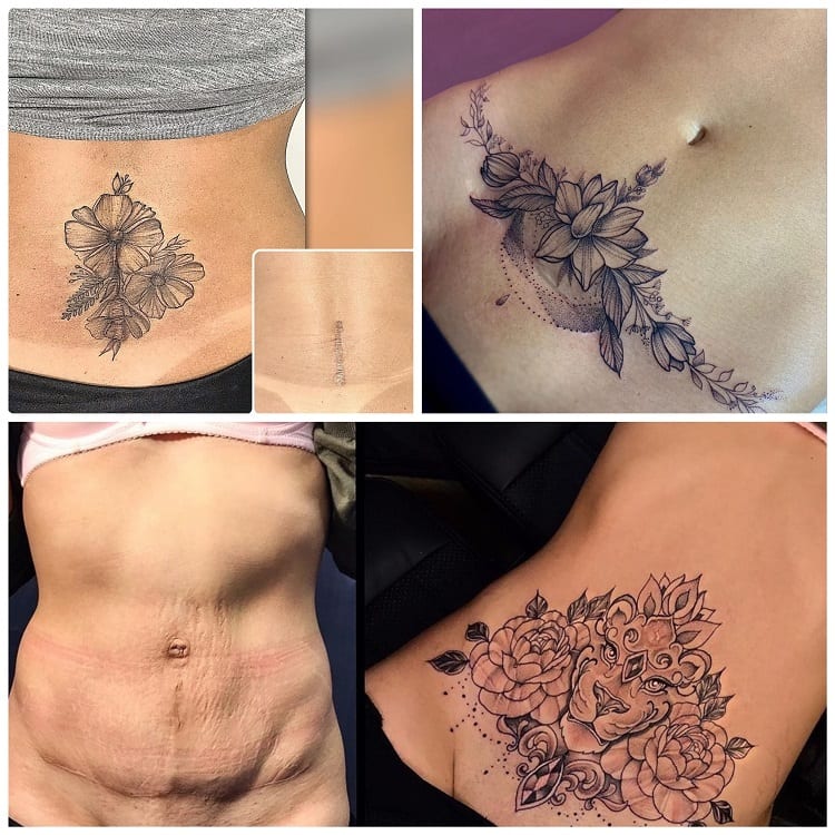 três tatuagens para cobrir cicatriz na barriga