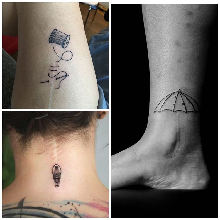 três sugestões criativas de tatuagem em cicatriz