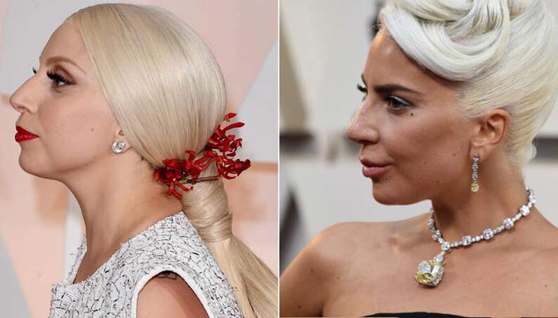 Lady Gaga antes e depois da harmonização facial