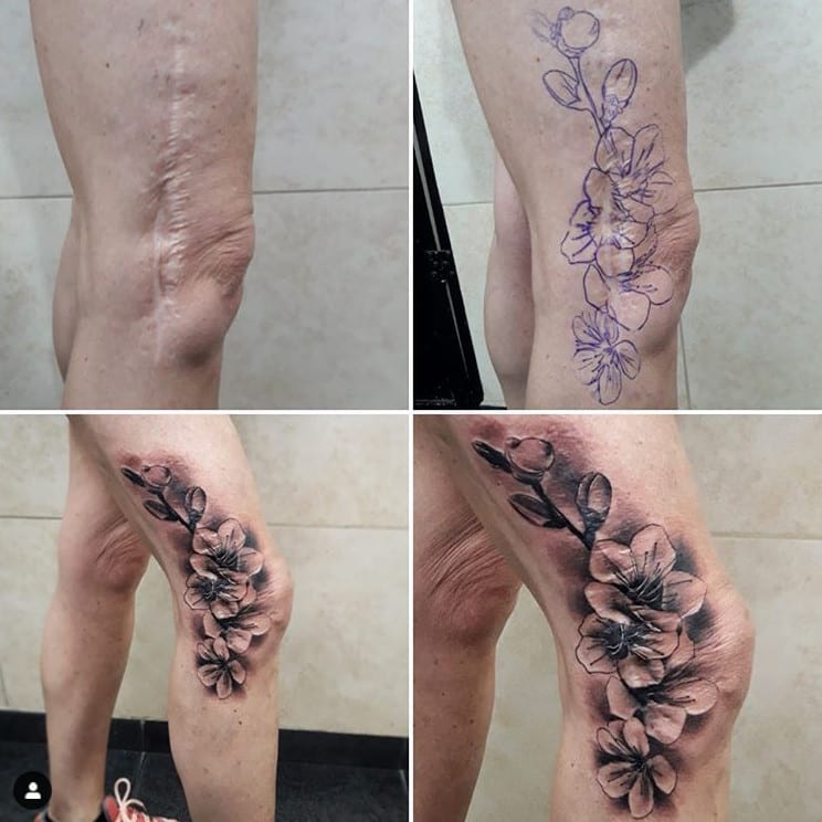 Tatuagem de flor cobre cicatriz grande na região da perna e joelho