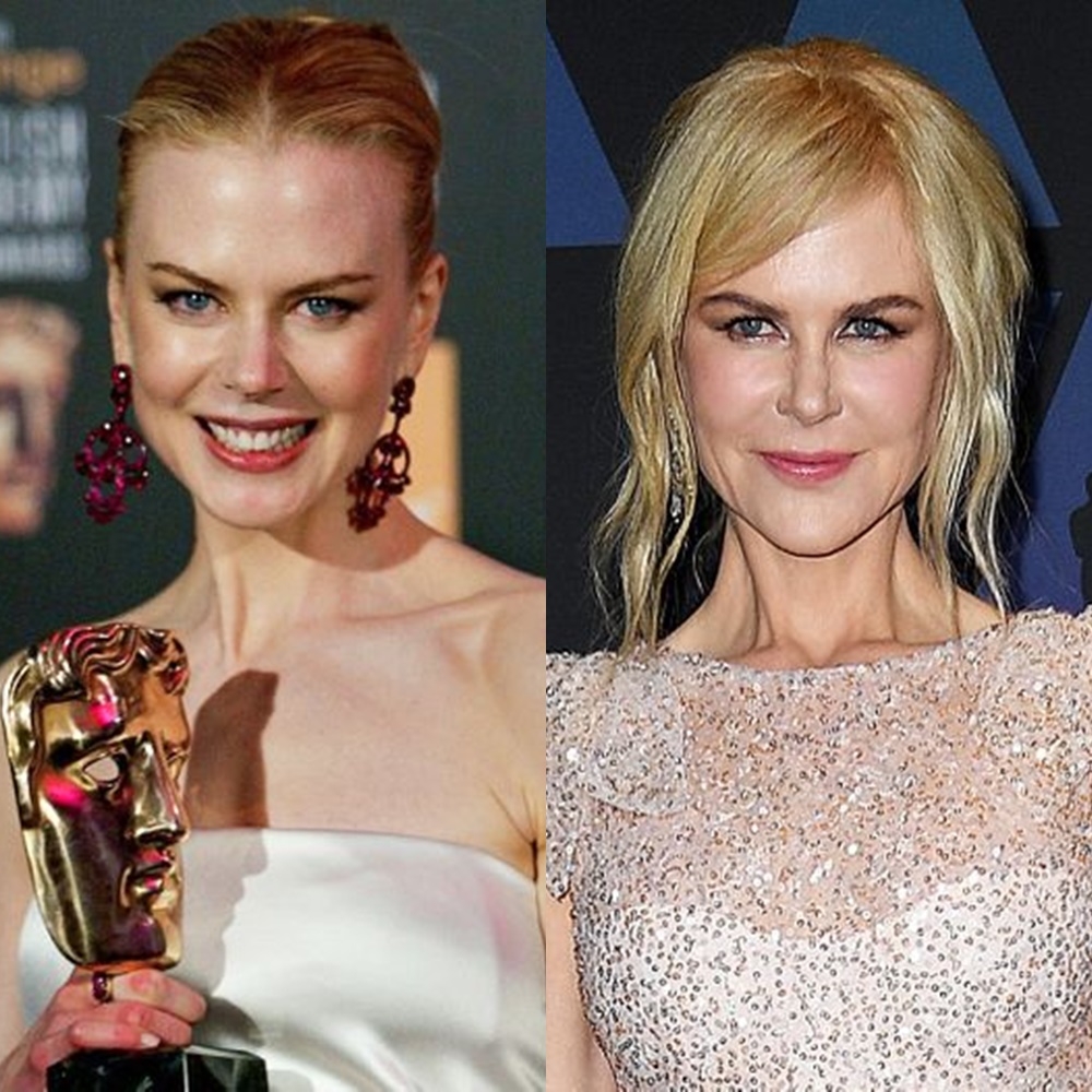 Nicole Kidman contornando o rosto.