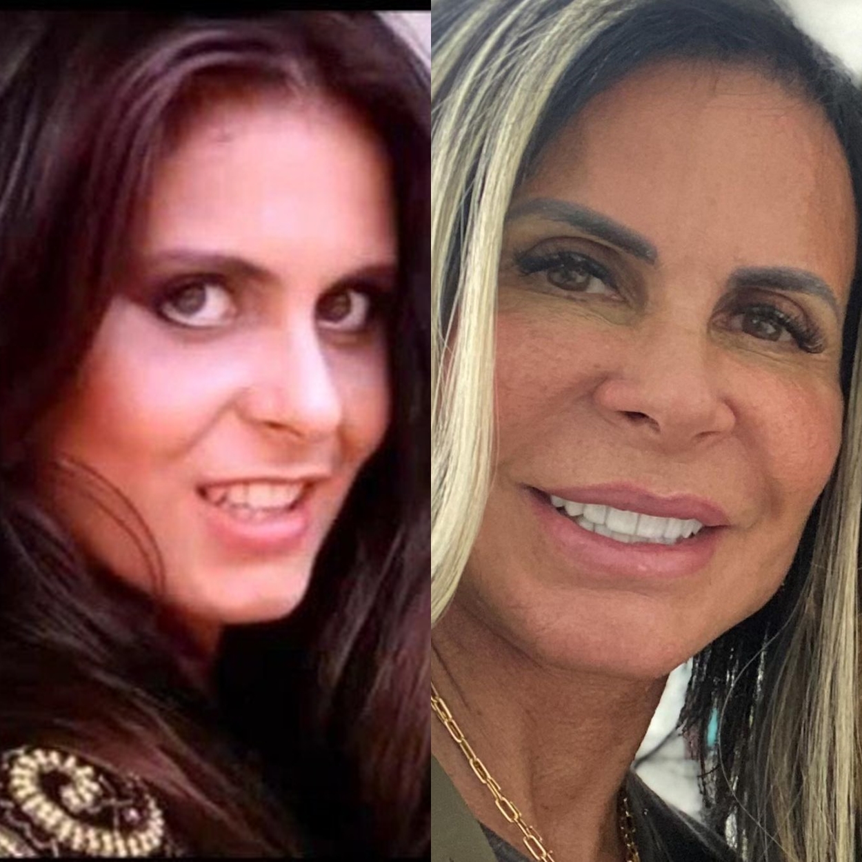 Gretchen antes e depois da fama.