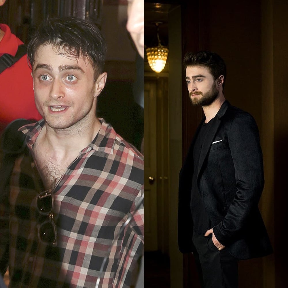Antes e depois do álcool: Daniel Radcliffe.
