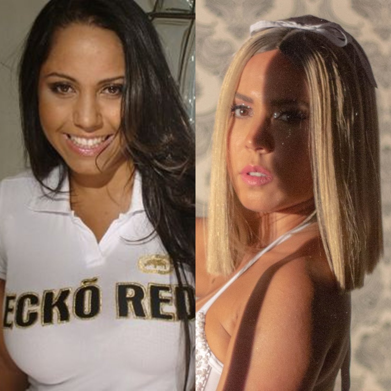 Mulher Melão antes e depois da fama.