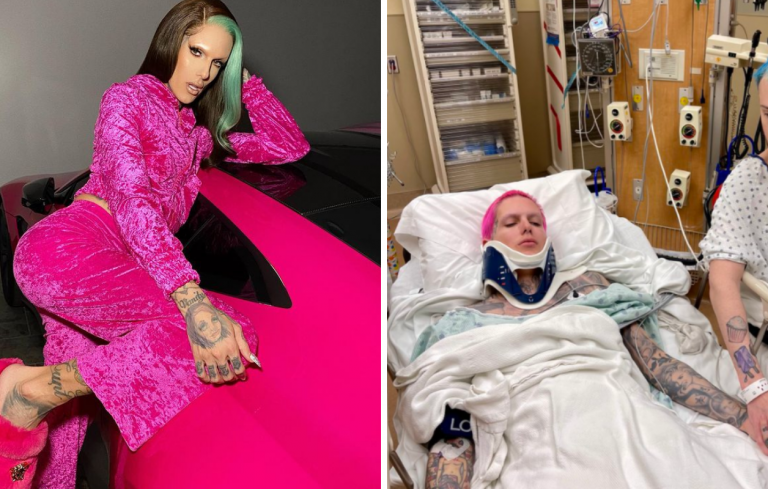 Jeffree Star, famoso maquiador e youtuber, sofre grave acidente