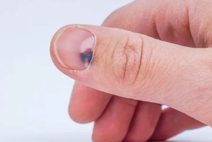 unhas unhas