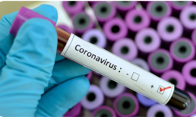 Novo teste rápido identifica o Covid-19 em apenas 1 segundo