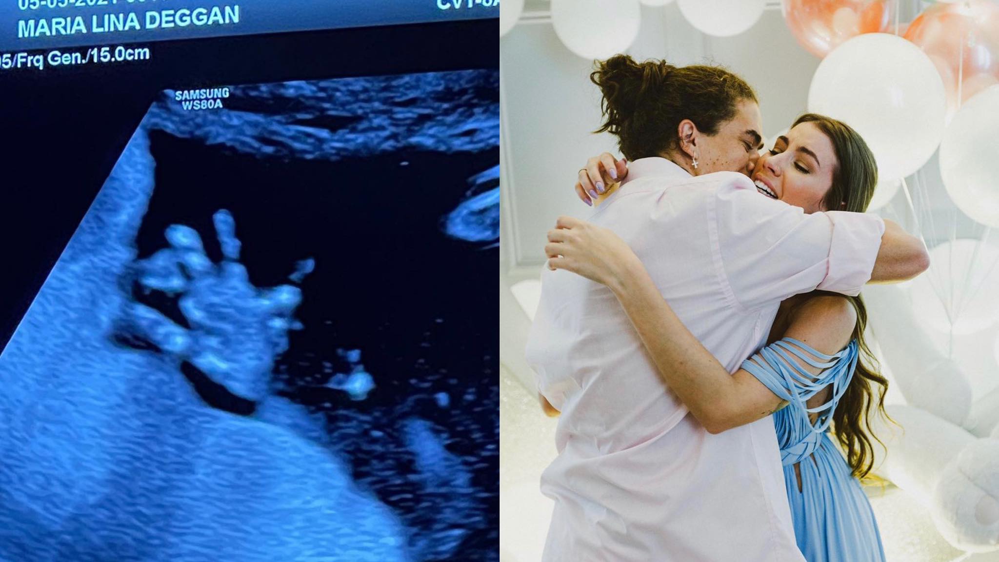 Whindersson Nunes e Maria Lina anunciaram a gravidez em janeiro (montagem: Fashion Bubbles)