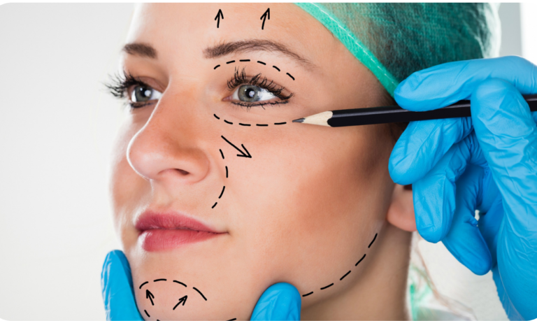 harmonização facial