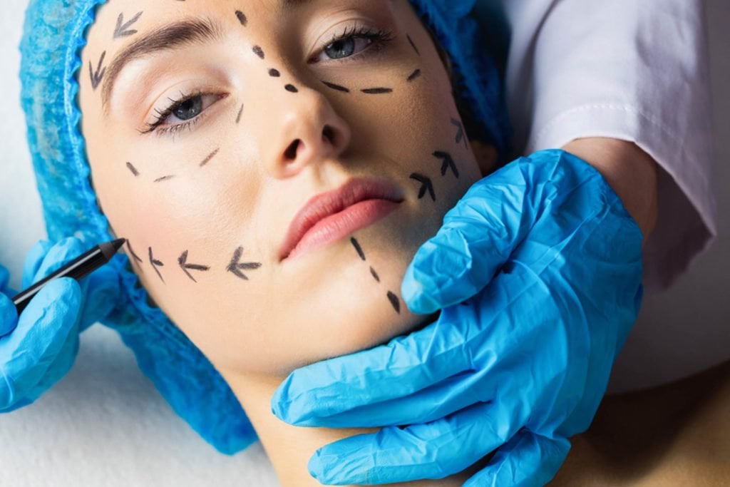 Mulher com rosto sendo marcado para harmonização facial
