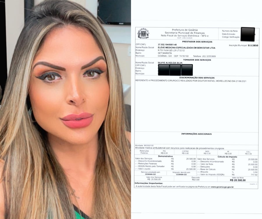 Foto da nota fiscal publicada pela jornalista Silvye Alves referente ao custo pela cirurgia no rosto.