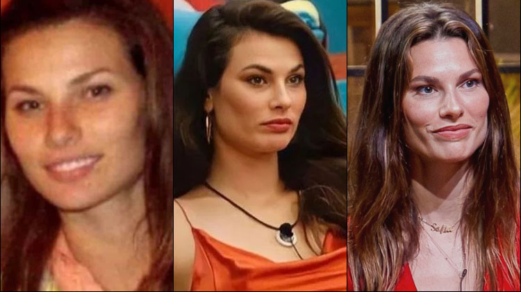 As mudanças no rosto de Dayane Mello (antes e depois)