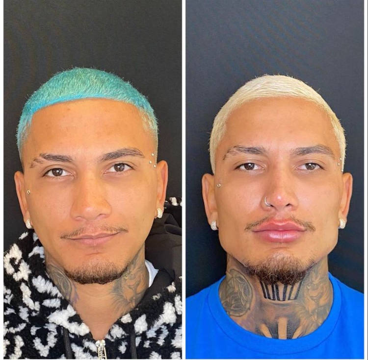 Dynho Alves antes e depois