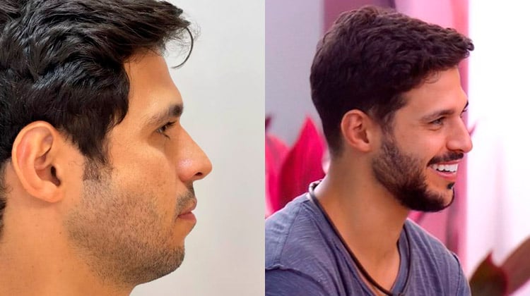 Rodrigo antes e depois