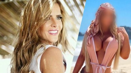 Antes e depois: Denise Rocha mexe em rosto e conta sobre procedimentos; veja mudanças