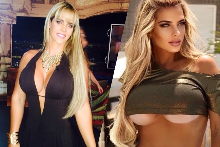 Denise Rocha antes e depois de mudanças no rosto Denise Rocha antes e depois de mudanças no rosto