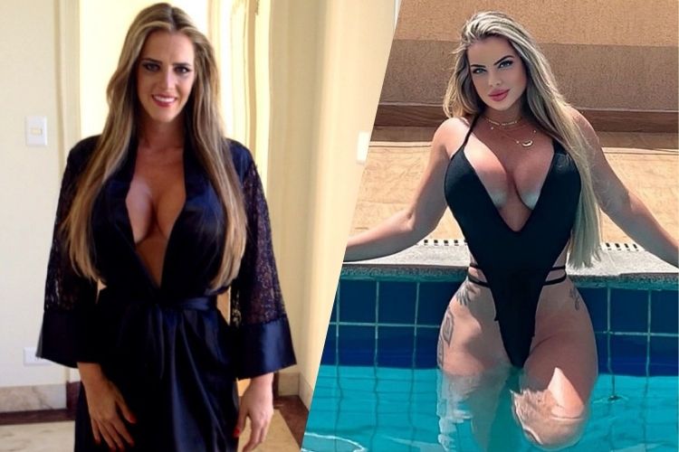 Denise Rocha antes e depois de mudanças no rosto Denise Rocha antes e depois de mudanças no rosto