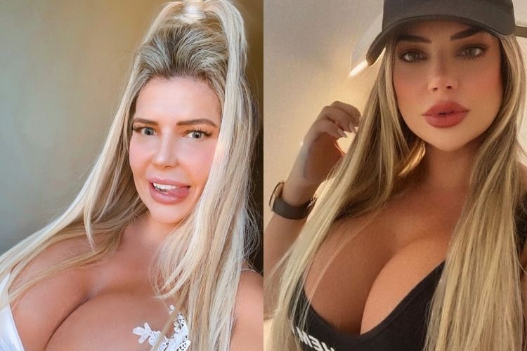 Denise Rocha antes e depois de mudanças no rosto Denise Rocha antes e depois de mudanças no rosto