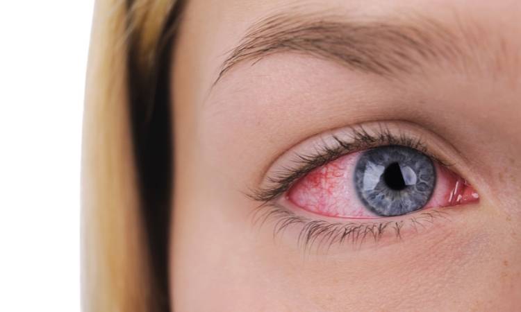Mulher de olhos azuis, vermelhos.