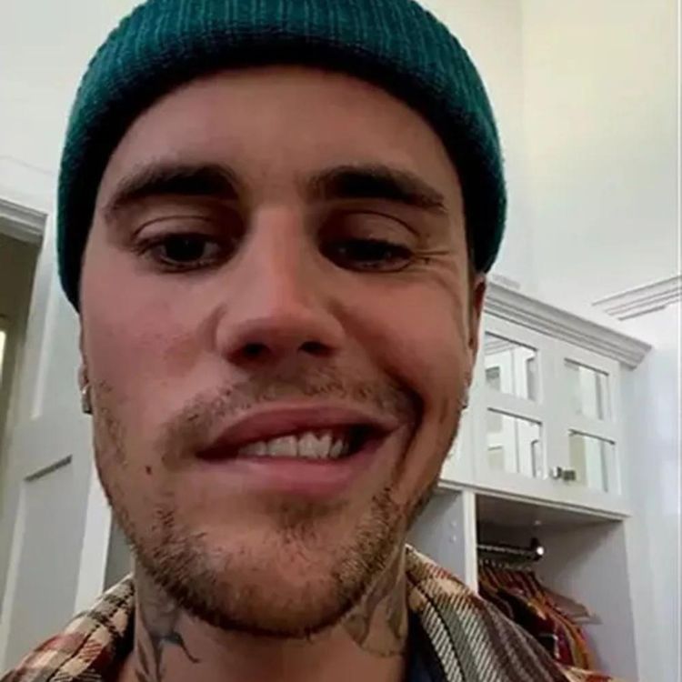 Justin Bieber mostrou como está seu rosto