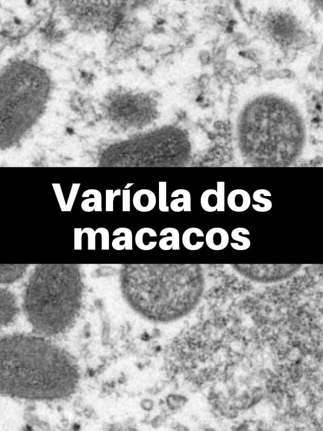 1º caso de varíola dos macacos no Brasil