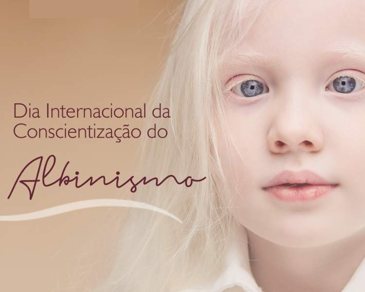 Foto sobre Dia Internacional de Conscientização sobre o Albinismo, 13 de junho.