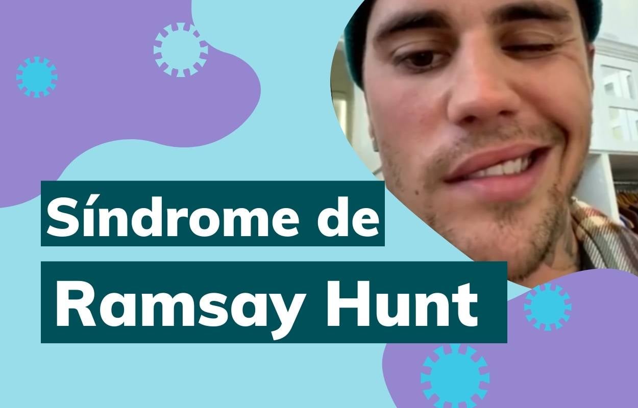 Síndrome de Ramsay Hunt.