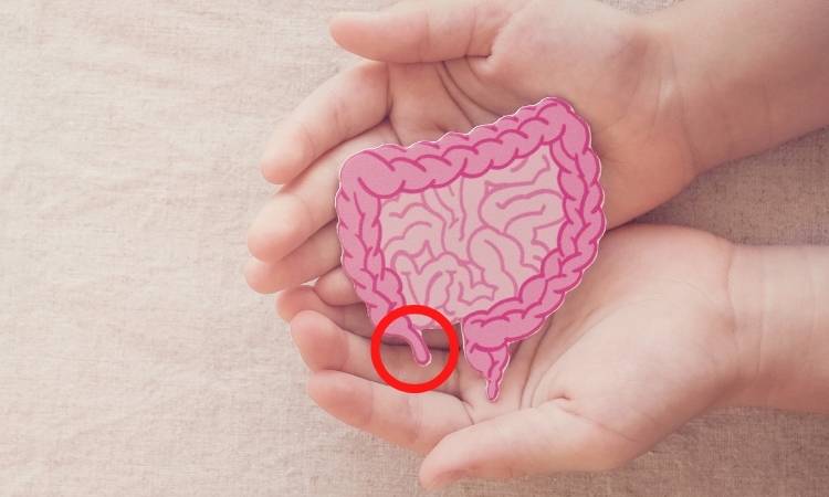 Apêncide. Mãos segurando um desenho de um intestino, com o apêndice circulado em vermelho