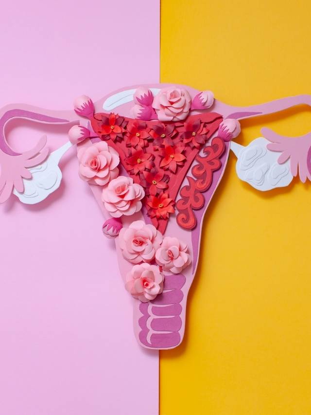 Endometriose.
