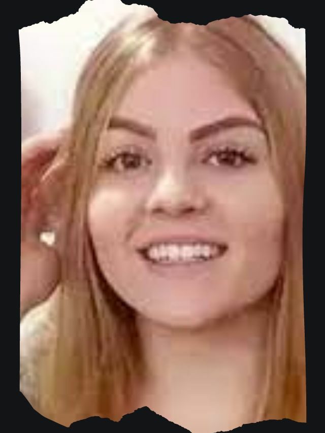 Antes e depois da harmonização facial dos famosos