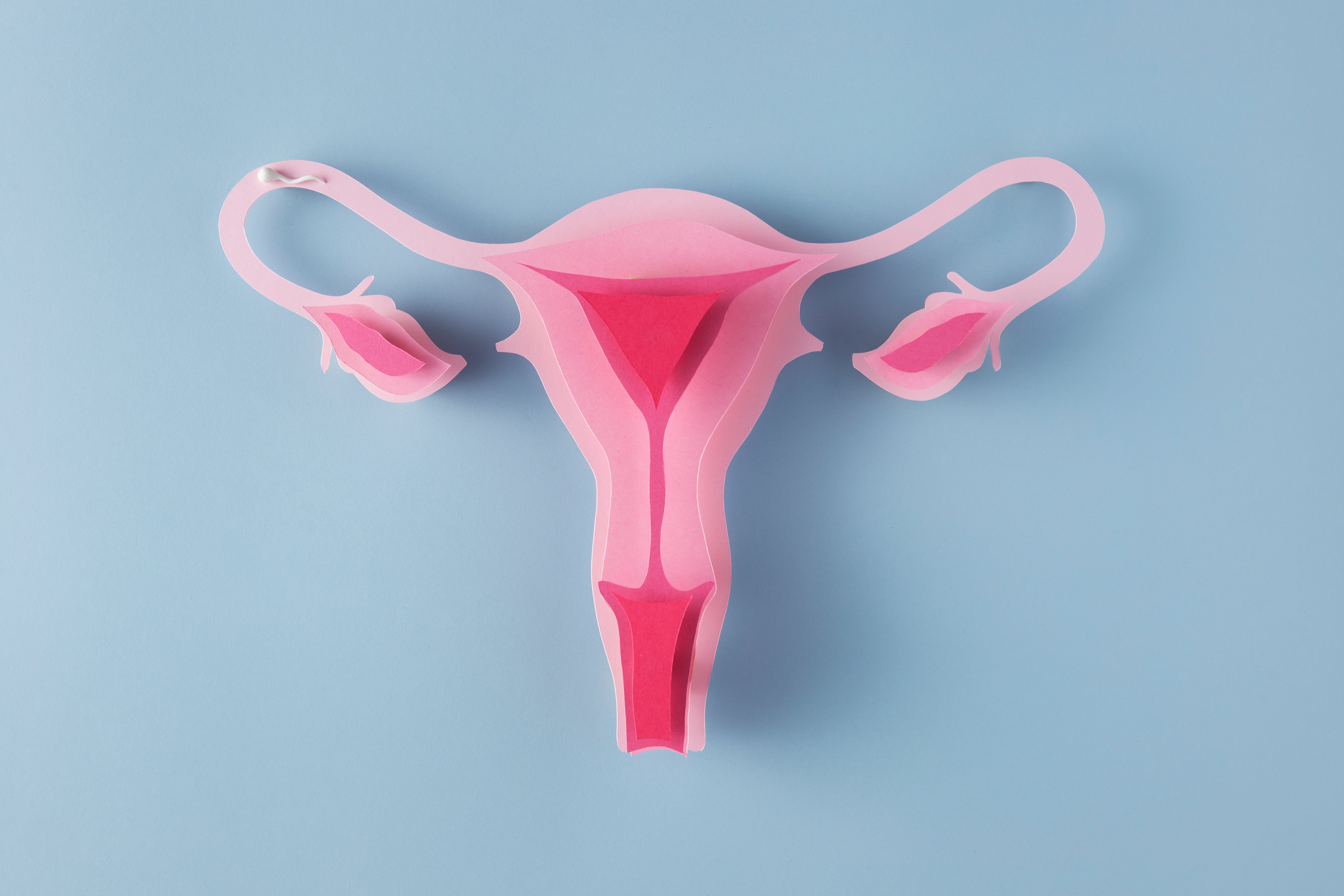 mitos e verdades sobre endometriose