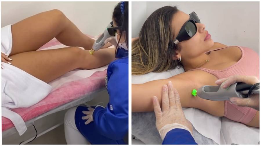 montagem com duas fotos de mulheres fazendo depilação a laser na Estética FIT, uma nas pernas e a outra na axila