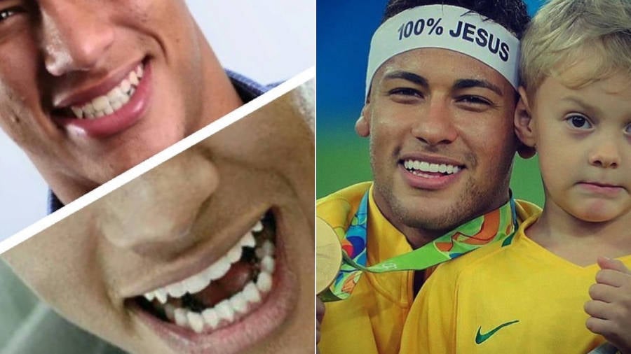 Foto de Neymar sorrindo, a primeira foto antes das lentes de contato e a segunda com as lentes