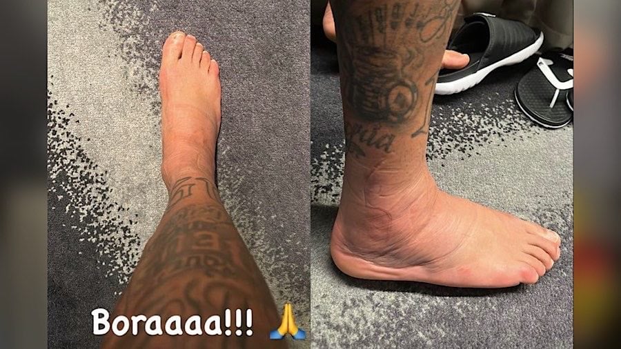 Neymar pé lesionado.