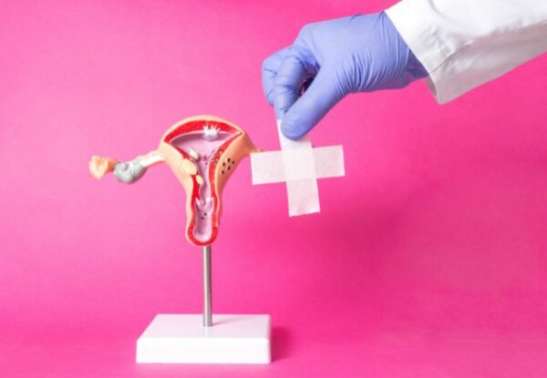 Saiba quais os tratamentos para endometriose