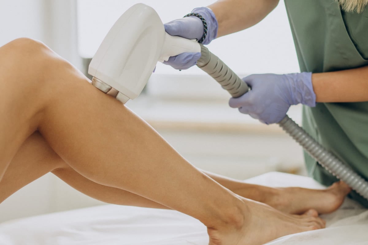 mulher fazendo depilação a laser na perna