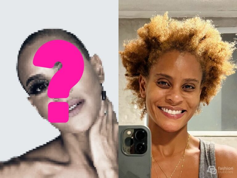 Foto de Aline Wirley hoje e careca.