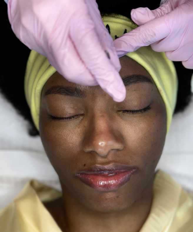 Tina Calamba fazendo procedimentos estéticos no rosto após eliminação do BBB 23.