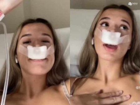 Montagem de duas fotos de mulher com curativos no nariz.