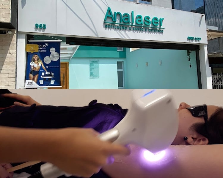 Montagem com duas fotos, uma da fachada da Analaser em são paulo, e outra de uma mulher fazendo depilação a laser na axila na Analaser