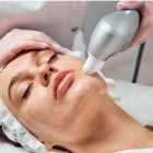 mulher deitada com tratamento ultraformer no rosto