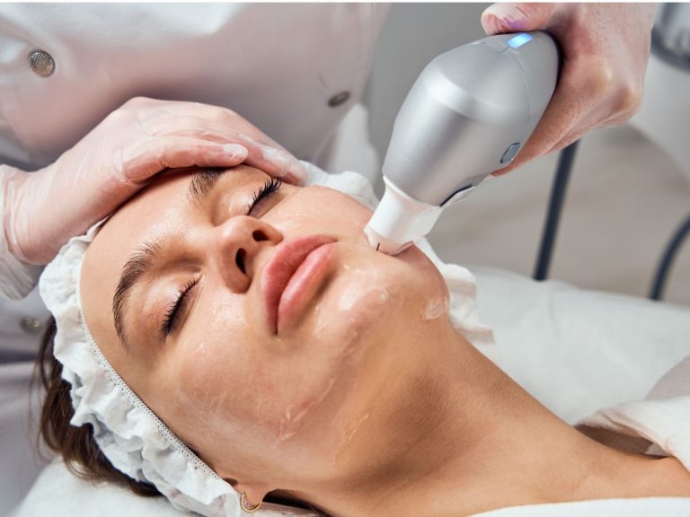 mulher deitada com tratamento ultraformer no rosto